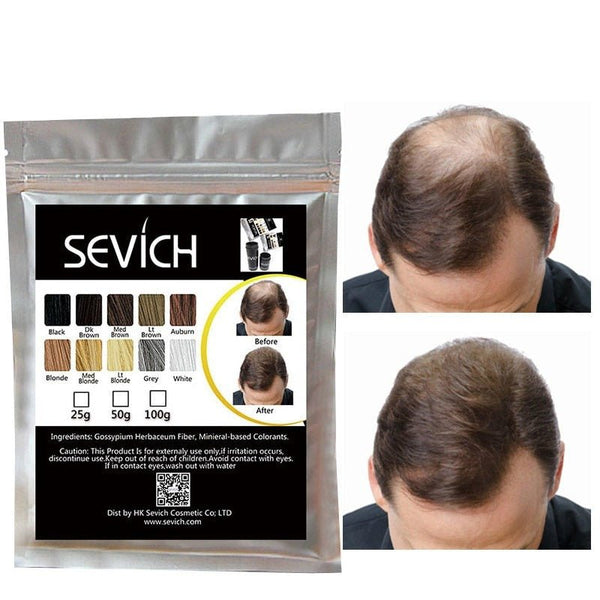 Hair thickening for thinning hair and partial baldness